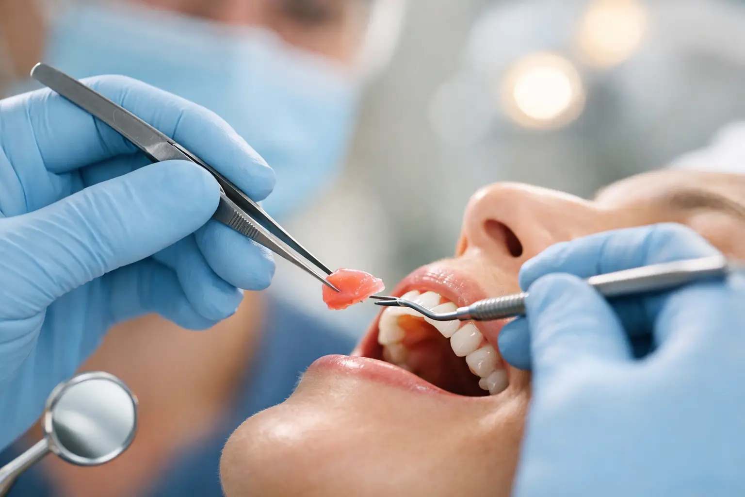 Gum Grafting in Scarborough for Healthier Gums