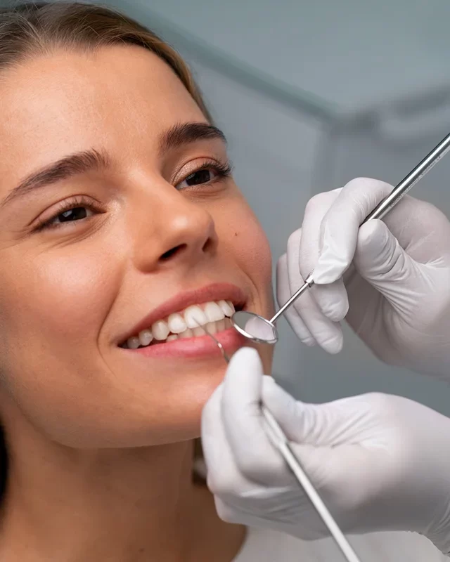 Dental Bonding-02
