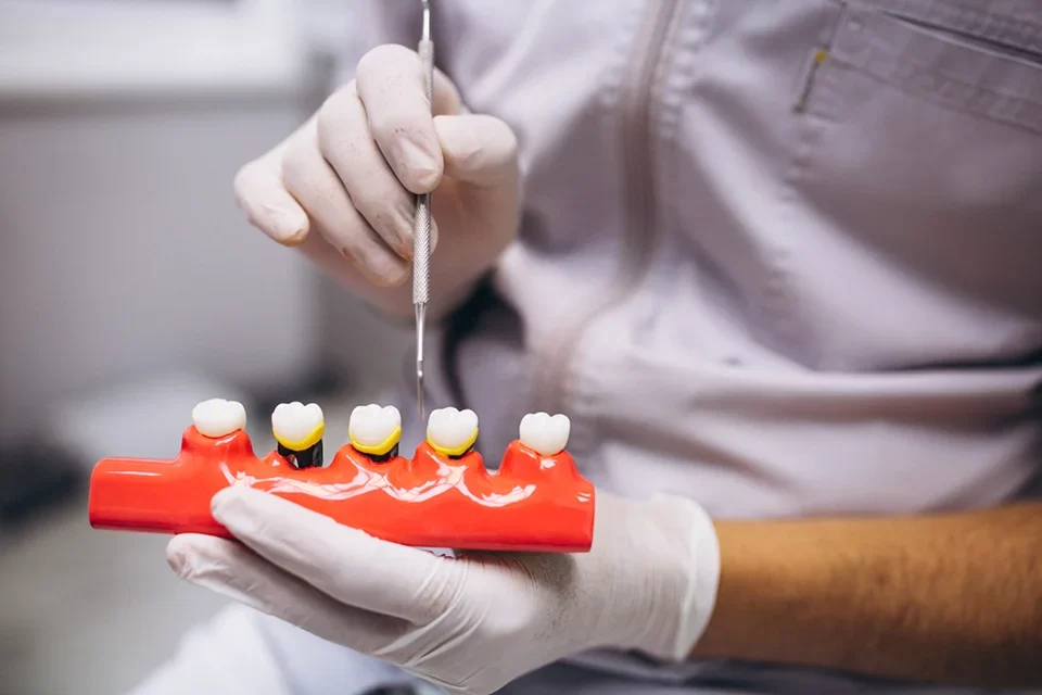 Dental Crowns-01