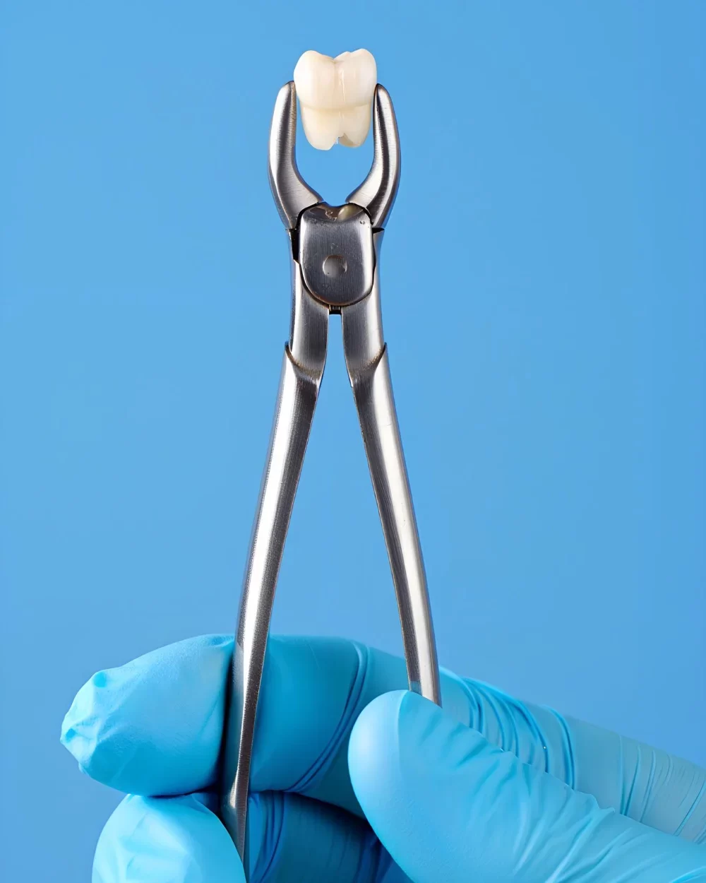 Dental Extraction – Bright Smile Dental Clinic