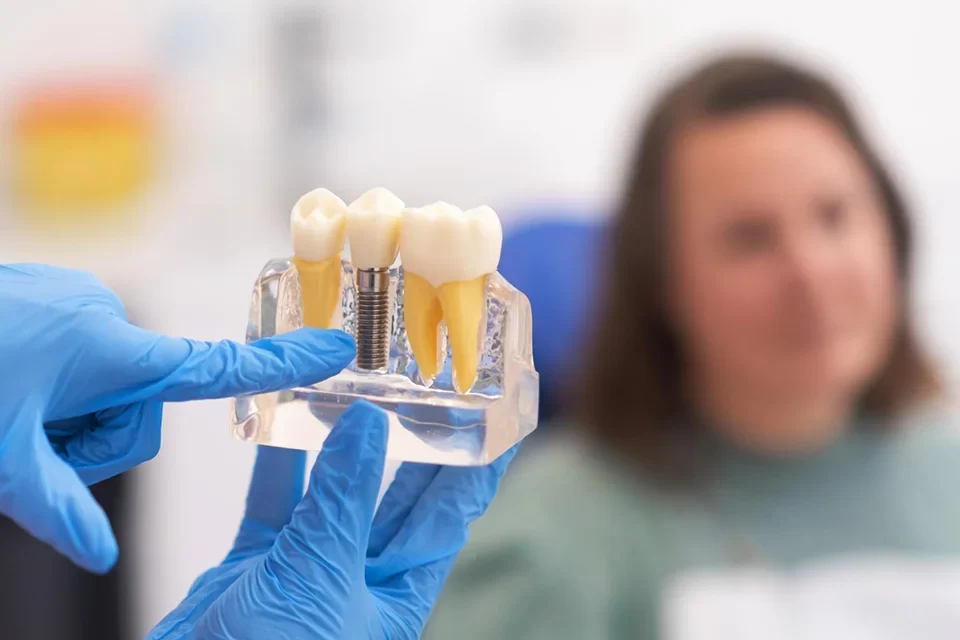 Dental Implants-p1