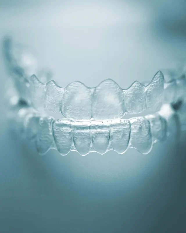 Invisalign-02